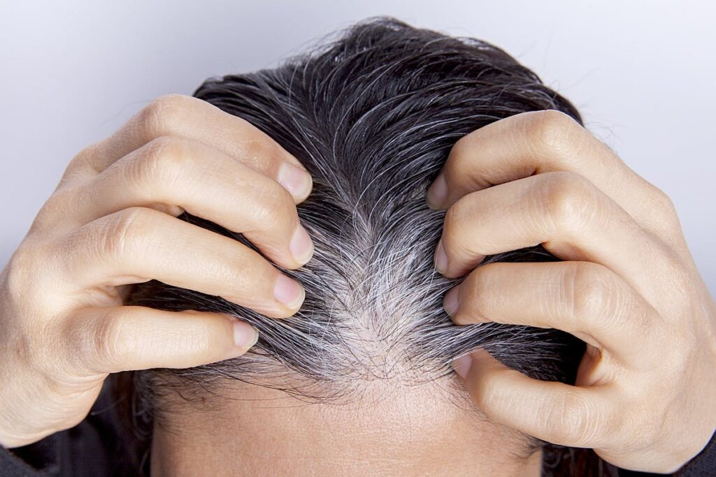 4 Most Common Types Of Hair Loss Know Them To Handle Them