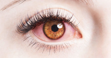 Why-Your-Contact-Lenses-Are-Giving-Red-Eyes