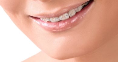 Reasons to get Orthodontic Treatment