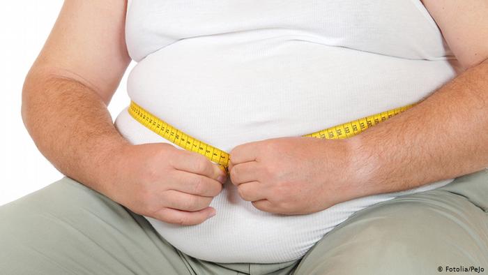 Obesity Causes, Symptoms, Treatment