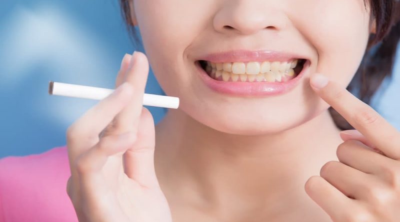 smokers teeth cleaning