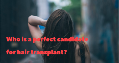 who is perfect for hair transplant
