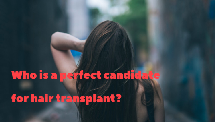 who is perfect for hair transplant