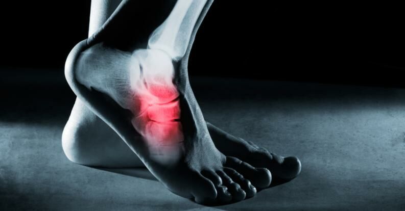 5 Common causes of foot pain
