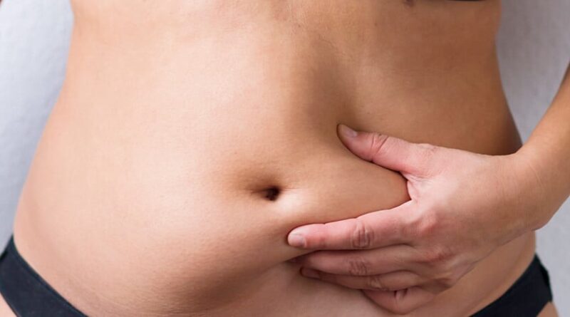 5 Tips to Recover from A Tummy Tuck