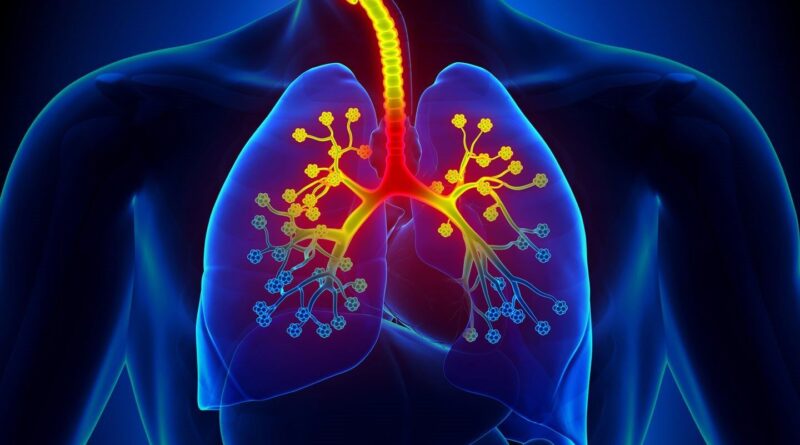 Common Causes of Asthma Attacks - 2022 - trendmut