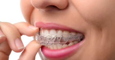 Who Can Get Invisalign and What Are the Benefits?