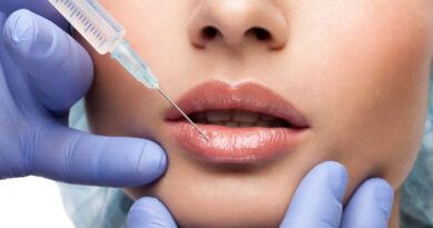 5 Incredible Advantages of Lip Fillers in Vancouver