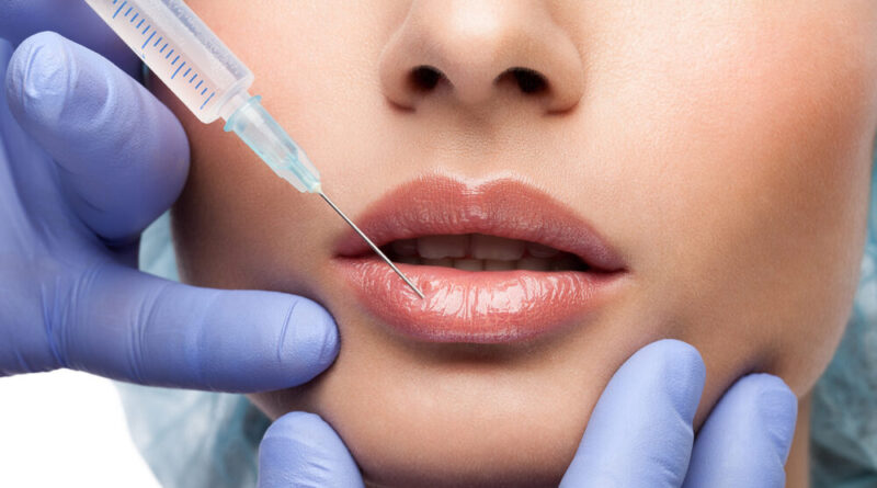 5 Incredible Advantages of Lip Fillers in Vancouver