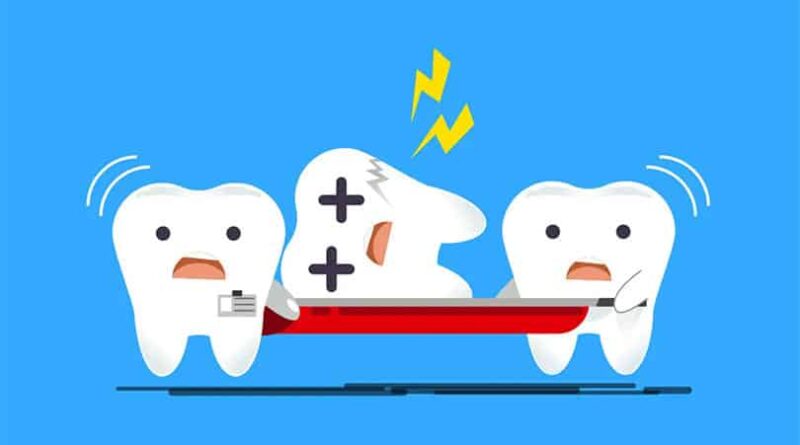 Dental Emergencies