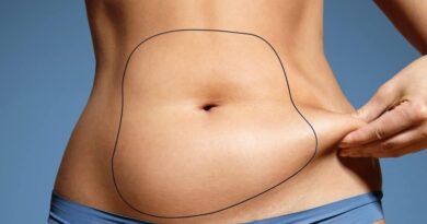 Liposuction