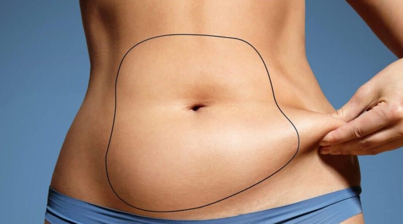 Liposuction